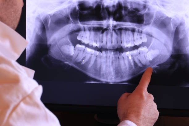 Best Walk-In Emergency Dentist in Ypsilanti, MI